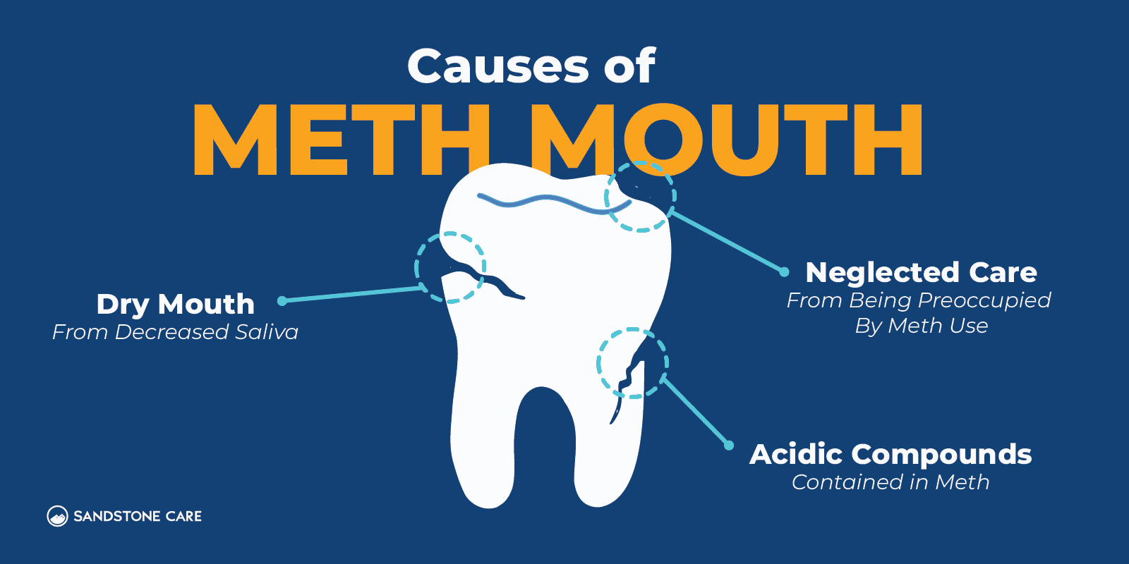 Meth Symptoms Graphics_09 Causes of Meth Mouth Inline Image