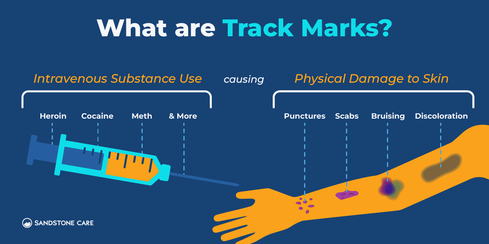 Track Marks Graphics_01 What Are Track Marks Inline Image