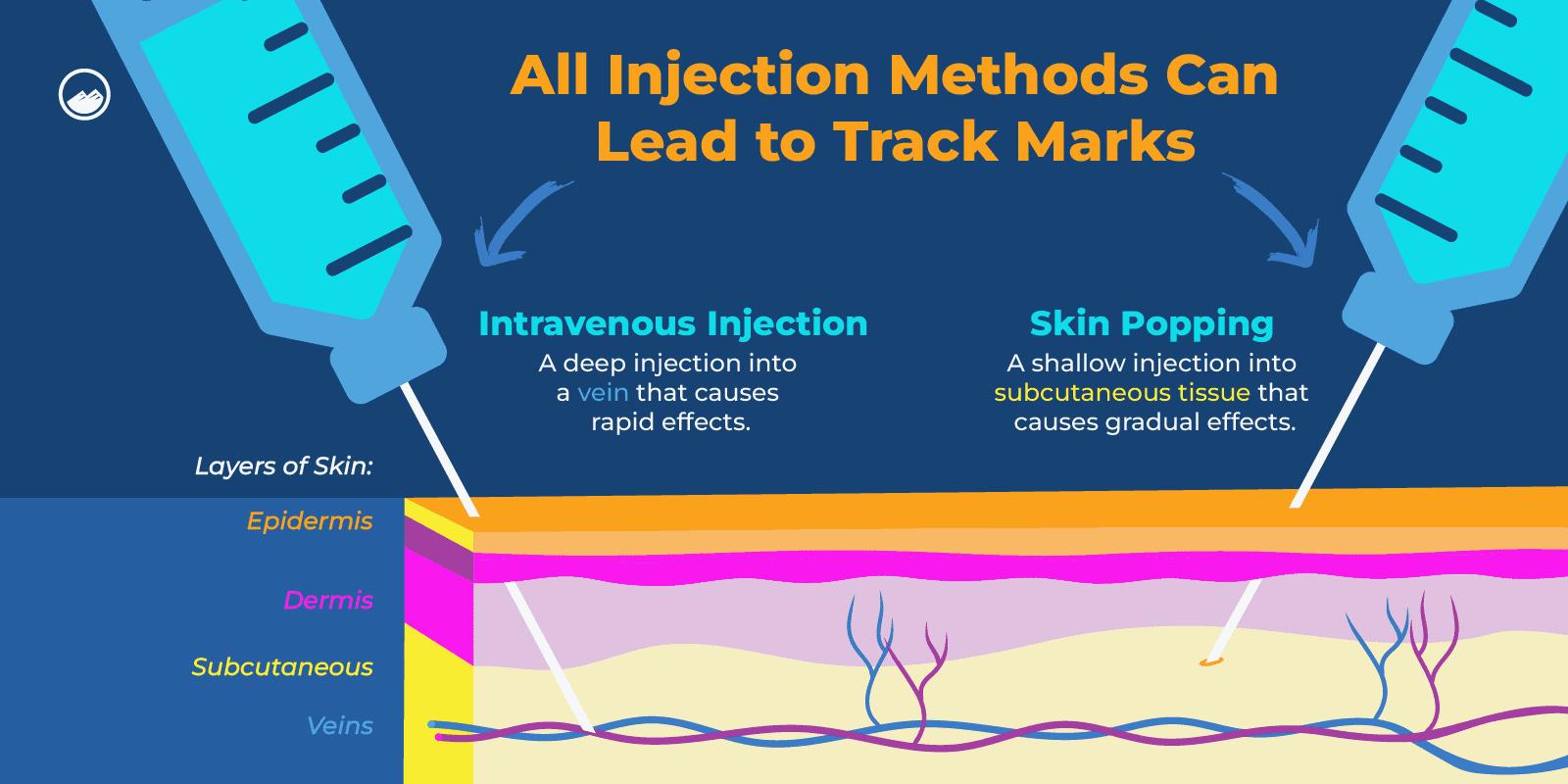 Track Marks Graphics_02 Intravenous Injection VS Skin Popping Leading to Track Marks Inline Image
