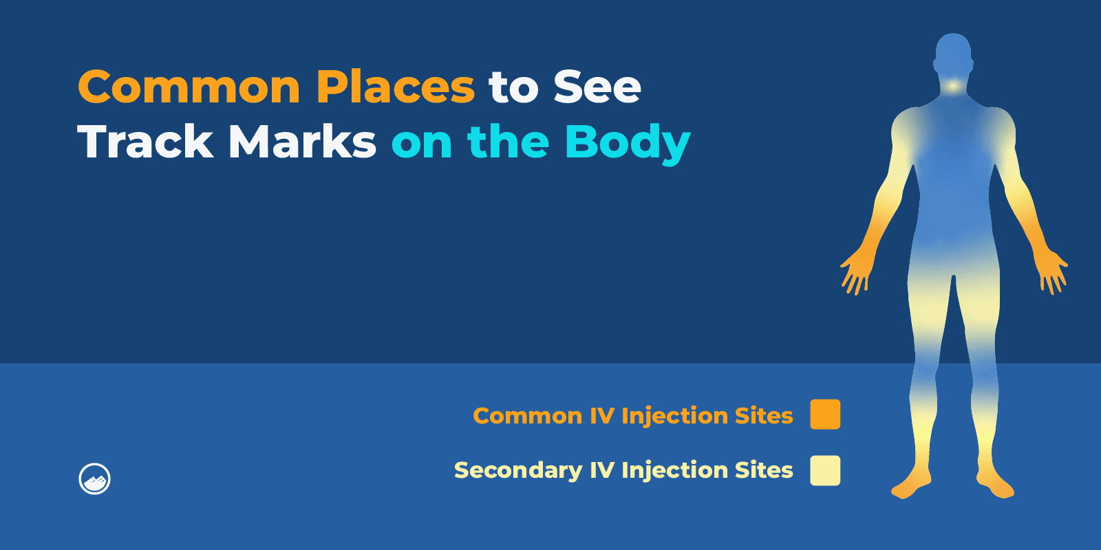 Track Marks Graphics_05 Common Places to See Track Marks on the Body Inline Image