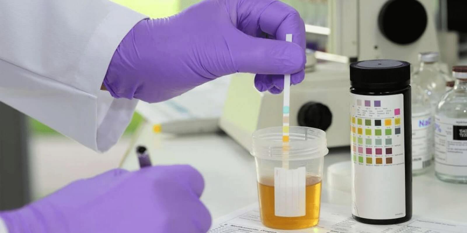 Hands wearing purple lab gloves performing a lab test